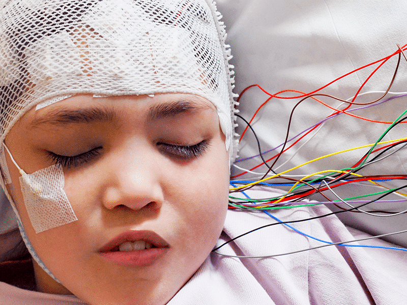 What Causes Seizures?