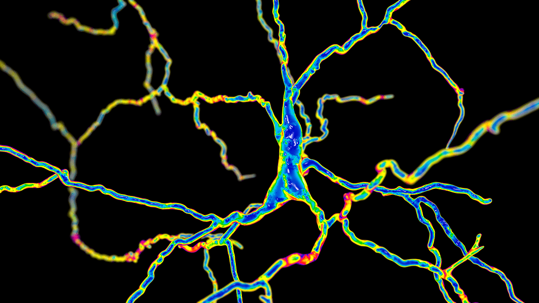 Huntington's neurons